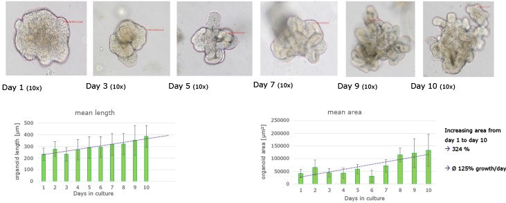 Morphology and growth of untreated human colon organoids. Human colonic organoids are expanded in 3D Matrigel® matrix domes for a 10 day period and increase in overall mean length and area.