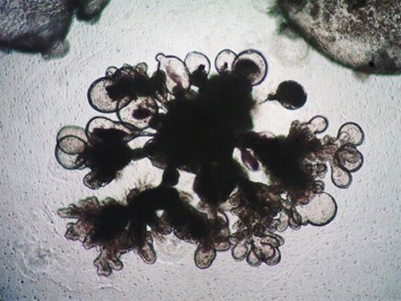 Human lung organoids.