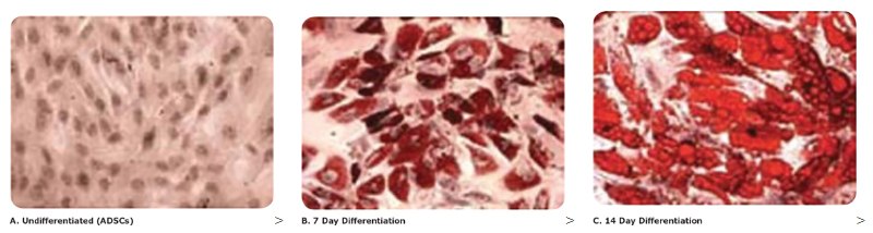 Oil Red O staining was used to measure the increased lipid content of adipocytes compared to undifferentiated cells