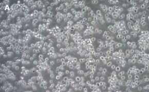 Brightfield imaging of ALMC-1 cells on Millicell<sup>®</sup> DCI Digital Cell Imager at 10X magnification