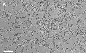 Brightfield imaging of Oli-neu oligodendrocytes on Millicell<sup>®</sup> DCI Digital Cell Imager at 10X magnification