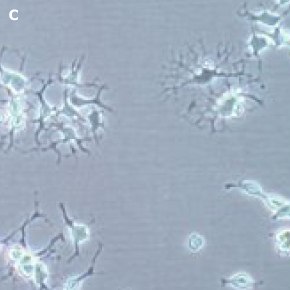 Differentiated Oli-neu oligodendrocytes imaged using the Millicell<sup>®</sup> DCI Digital Cell Imager