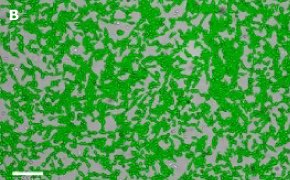 Brightfield imaging of OSUMMER.1 cells on Millicell<sup>®</sup> DCI Digital Cell Imager at 10X magnification with mask