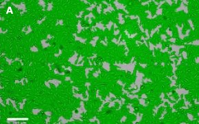 Brightfield imaging of OSUMMER.10 cells on Millicell<sup>®</sup> DCI Digital Cell Imager at 10X magnification