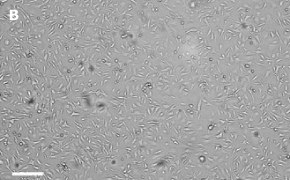 Brightfield imaging of OSUMMER.10 cells on Millicell<sup>®</sup> DCI Digital Cell Imager at 10X magnification with mask