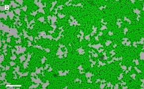 Brightfield imaging of OSUMMER.11 cells on Millicell<sup>®</sup> DCI Digital Cell Imager at 10X magnification with mask