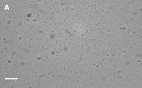 Brightfield imaging of OSUMMER.2 cells on Millicell<sup>®</sup> DCI Digital Cell Imager at 10X magnification