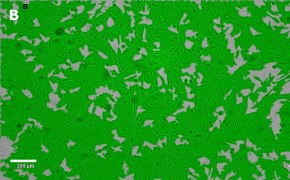 Brightfield imaging of OSUMMER.2 cells on Millicell<sup>®</sup> DCI Digital Cell Imager at 10X magnification with mask