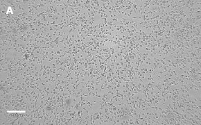 Brightfield imaging of OSUMMER.3 cells on Millicell<sup>®</sup> DCI Digital Cell Imager at 10X magnification