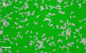 Brightfield imaging of OSUMMER.3 cells on Millicell<sup>®</sup> DCI Digital Cell Imager at 10X magnification with mask