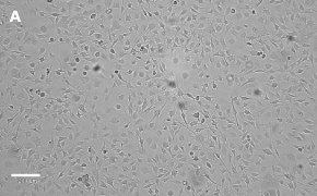 Brightfield imaging of OSUMMER.8 cells on Millicell<sup>®</sup> DCI Digital Cell Imager at 10X magnification