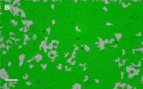 Brightfield imaging of OSUMMER.8 cells on Millicell<sup>®</sup> DCI Digital Cell Imager at 10X magnification with mask