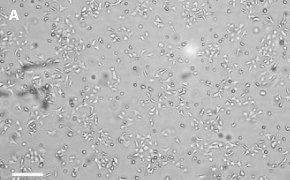 Brightfield imaging of Scp2 cells on Millicell<sup>®</sup> DCI Digital Cell Imager at 10X magnification