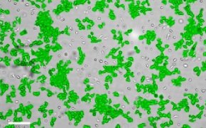 Brightfield imaging of Scp2 cells on Millicell<sup>®</sup> DCI Digital Cell Imager at 10X magnification with mask