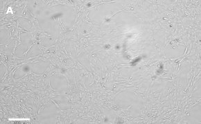 Brightfield imaging of CNS-1 cells on Millicell<sup>®</sup> DCI Digital Cell Imager at 10X magnification