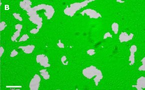 Brightfield imaging of CNS-1 cells on Millicell<sup>®</sup> DCI Digital Cell Imager at 10X magnification with mask