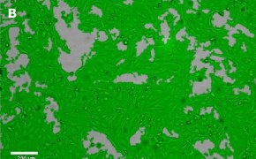 Brightfield imaging of LX-2 Cas9 cells on Millicell<sup>®</sup> DCI Digital Cell Imager at 10X magnification with mask