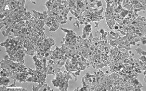 Brightfield imaging of MCF-7 BUS cells on Millicell<sup>®</sup> DCI Digital Cell Imager at 10X magnification