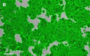 Brightfield imaging of MCF-7 BUS cells on Millicell<sup>®</sup> DCI Digital Cell Imager at 10X magnification with mask