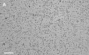 Brightfield imaging of OSUMMER.4 cells on Millicell<sup>®</sup> DCI Digital Cell Imager at 10X magnification
