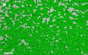 Brightfield imaging of OSUMMER.4 cells on Millicell<sup>®</sup> DCI Digital Cell Imager at 10X magnification with mask