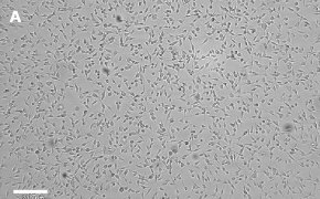 Brightfield imaging of OSUMMER.6 cells on Millicell<sup>®</sup> DCI Digital Cell Imager at 10X magnification