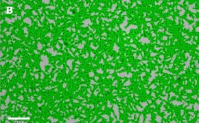 Brightfield imaging of OSUMMER.6 cells on Millicell<sup>®</sup> DCI Digital Cell Imager at 10X magnification with mask