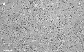 Brightfield imaging of OSUMMER.7 cells on Millicell<sup>®</sup> DCI Digital Cell Imager at 10X magnification