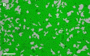 Brightfield imaging of OSUMMER.7 cells on Millicell<sup>®</sup> DCI Digital Cell Imager at 10X magnification with mask