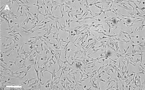 Brightfield imaging of OSUMMER.9 cells on Millicell<sup>®</sup> DCI Digital Cell Imager at 10X magnification