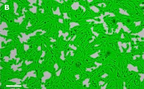 Brightfield imaging of OSUMMER.9 cells on Millicell<sup>®</sup> DCI Digital Cell Imager at 10X magnification with mask