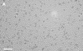Brightfield imaging of T24T cells on Millicell<sup>®</sup> DCI Digital Cell Imager at 10X magnification