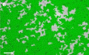 Brightfield imaging of T24T cells on Millicell<sup>®</sup> DCI Digital Cell Imager at 10X magnification with mask