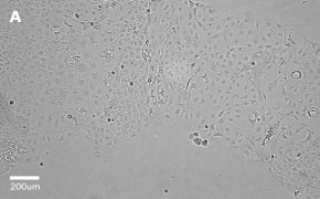 Brightfield imaging of Caco-2 cells on Millicell<sup>®</sup> DCI Digital Cell Imager at 10X magnification