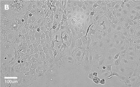 Brightfield imaging of Caco-2 cells on Millicell<sup>®</sup> DCI Digital Cell Imager at 20X magnification