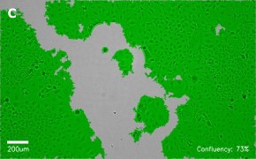 Brightfield imaging of Caco-2 cells on Millicell<sup>®</sup> DCI Digital Cell Imager at 10X magnification with mask