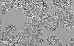Brightfield imaging of HT29 cells on Millicell<sup>®</sup> DCI Digital Cell Imager at 20X magnification