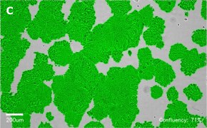 Brightfield imaging of HT29 cells on Millicell<sup>®</sup> DCI Digital Cell Imager at 10X magnification with mask