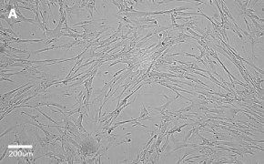 Brightfield imaging of IMR-90 cells on Millicell<sup>®</sup> DCI Digital Cell Imager at 10X magnification