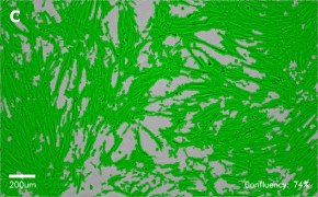 Brightfield imaging of IMR-90 cells on Millicell<sup>®</sup> DCI Digital Cell Imager at 10X magnification with mask