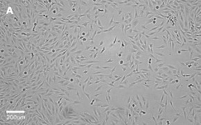 Brightfield imaging of MG-63 cells on Millicell<sup>®</sup> DCI Digital Cell Imager at 10X magnification
