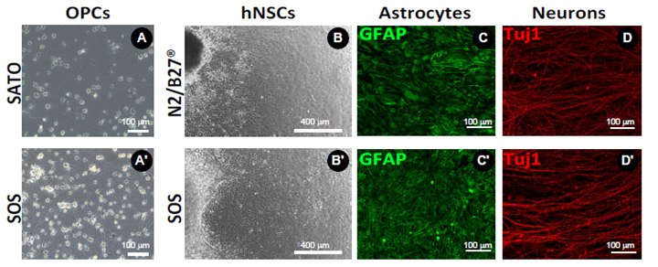 <b>A)</b> Comparison of the effects of DMEM/SATO vs. MEMO/SATO media on OPC morphology and proliferation. <b>B)</b> Comparison of neural epithelial cell differentiation from human iPSC generated embryonic bodies using serum free bplements N2+B27 (top panels) or SOS (bottom panels) to generate neurons (β-III) and astrocytes (GFAP) after approximately 5 weeks of differentiation. BrightCell™ media preserves normal cell function of OPCs and human neural stem cells