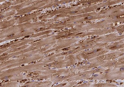 Immunohistochemical staining of cardiac muscle cell 