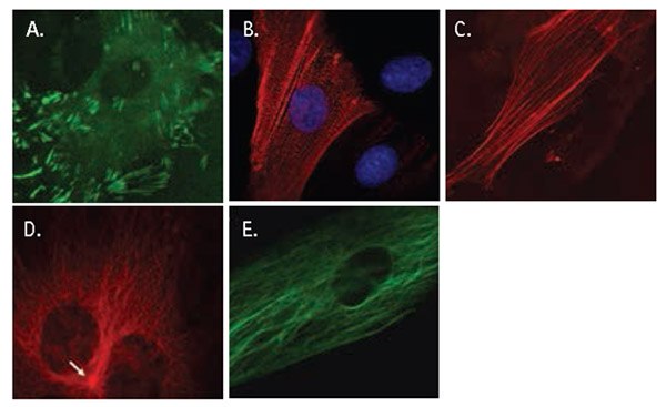 LentiBrite™ lentiviral biosensors localize to specific cytoskeletal elements