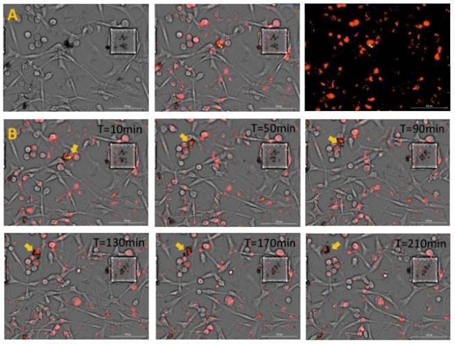 Live cell images from 3 day co-culture of MDA-MB-231 and CD4 T cells.