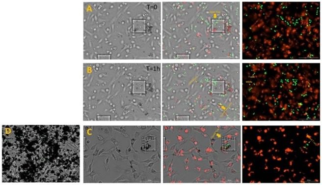 Live cell co-culture imaging of MDA-MB- 231 and CD4 T cells