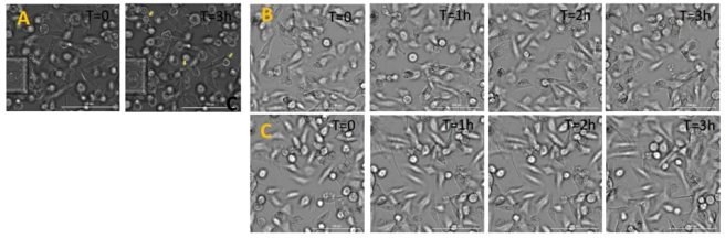 Live MDA-MB-231 cell imaging under static condition vs. dynamic physiological conditions