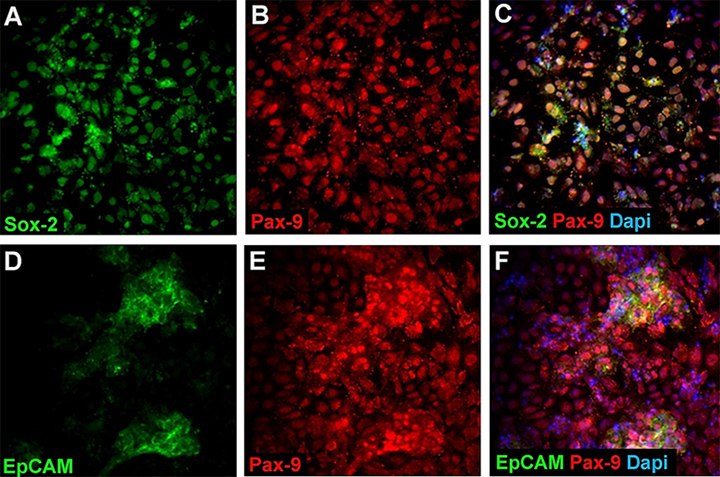 anterior-foregut-endoderm-marker-expression