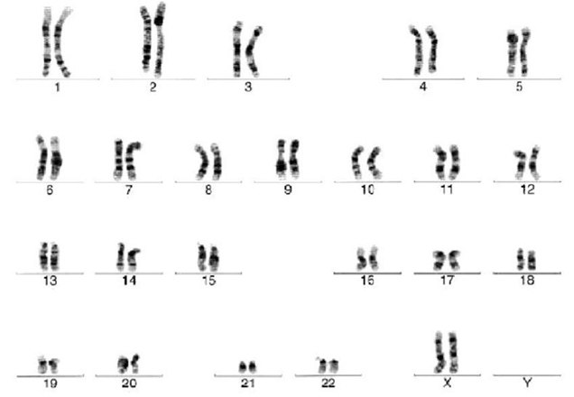 Cytogenetic analysis reveals a normal karyotype for H7 human embryonic stem cells.