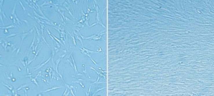 ECM matrix coating enables rapid expansion of fetal lung fibroblasts